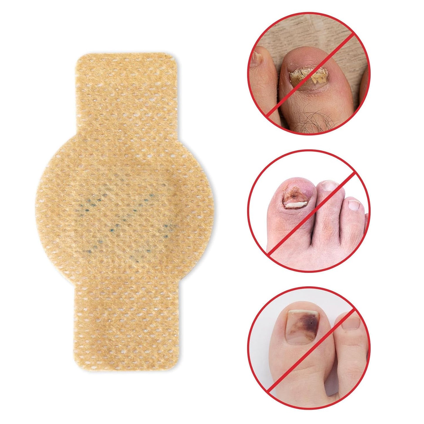 NailHeal™ - Fungal Nail Patches 🌿💅 ( Buy 1 Get 1 Free🔥🔥)